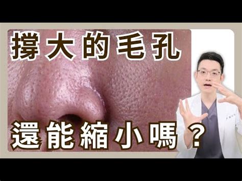 額頭 白毛|臉長白毛位置暗示何事？